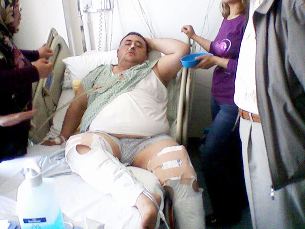 3 Ameliyat Geçirdi, 140 Kilodan 55 Kiloya Düştü