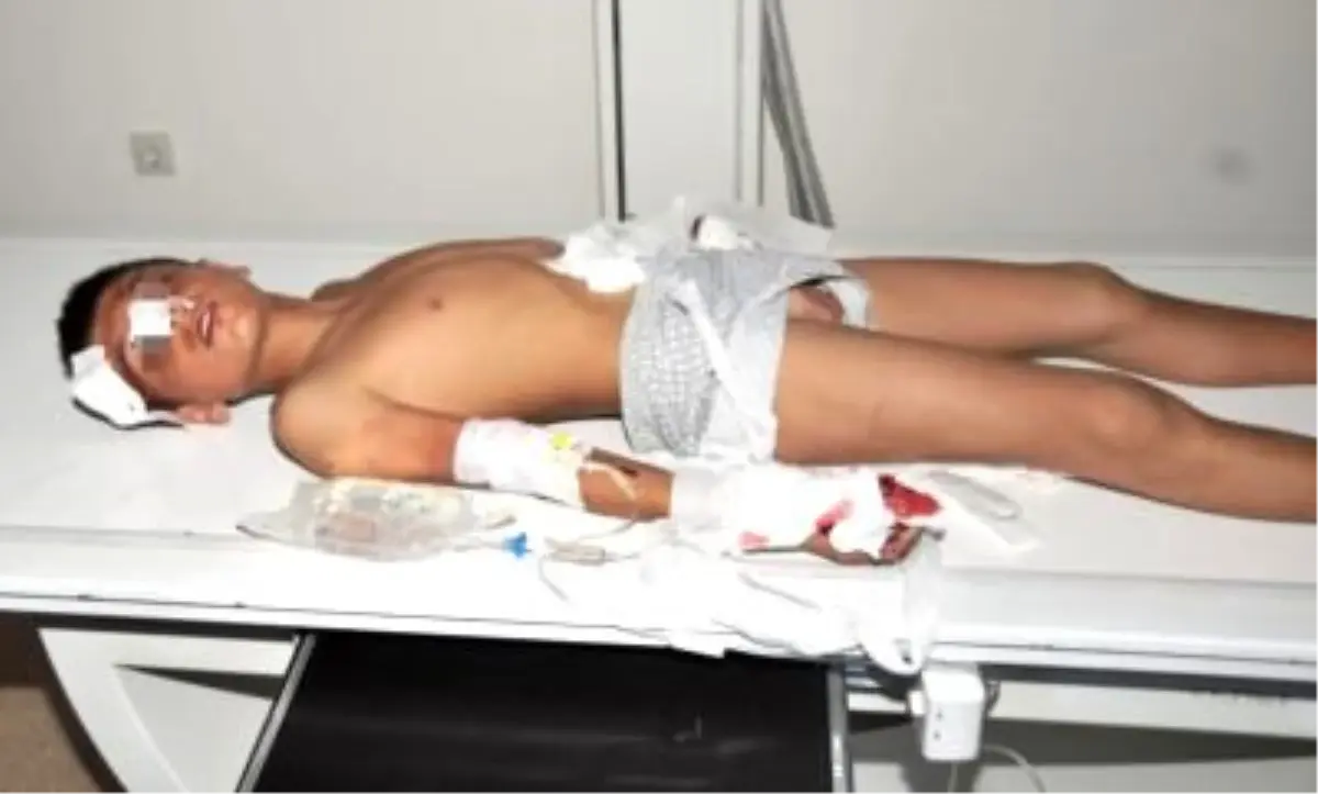 Elinde Bomba Patlayan Çocuk Ağır Yaralandı