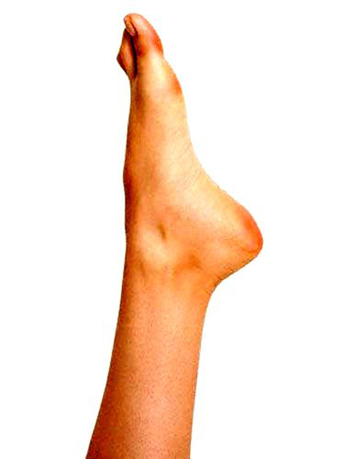 Topuktaki Çatlaklara Ne Yapmalı?