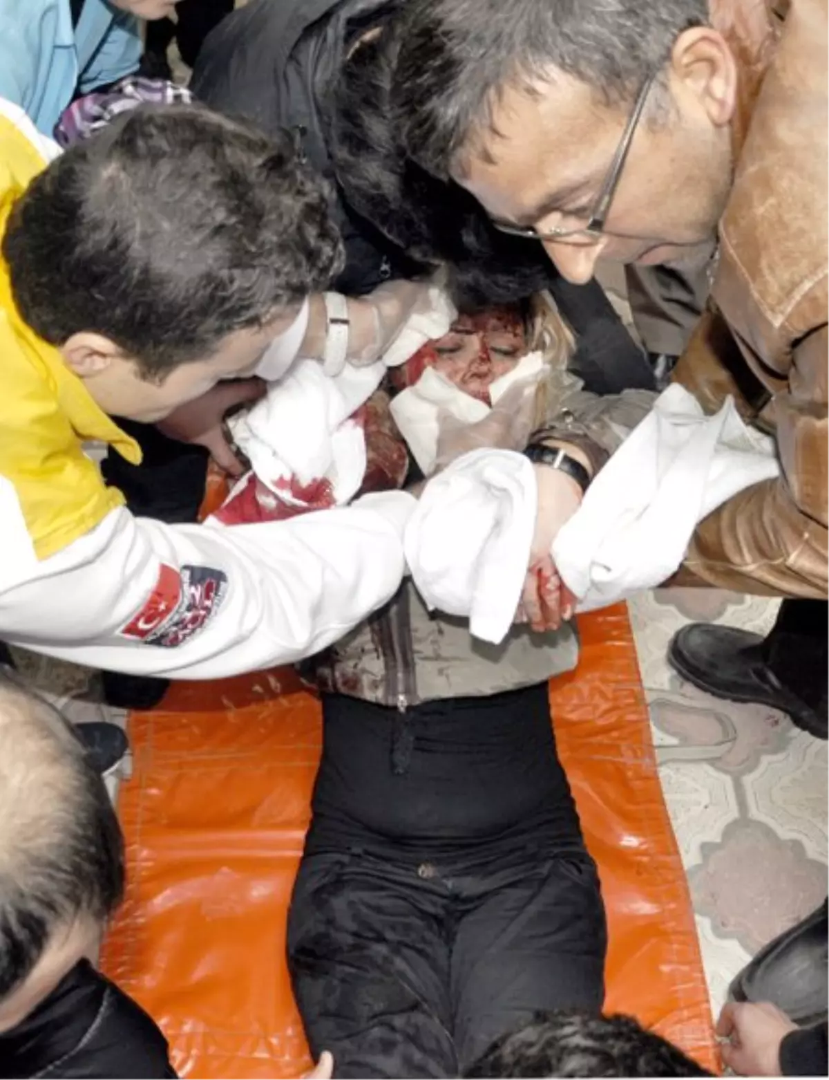 Eski Eşini Sokak Ortasında Falçatayla Yaraladı