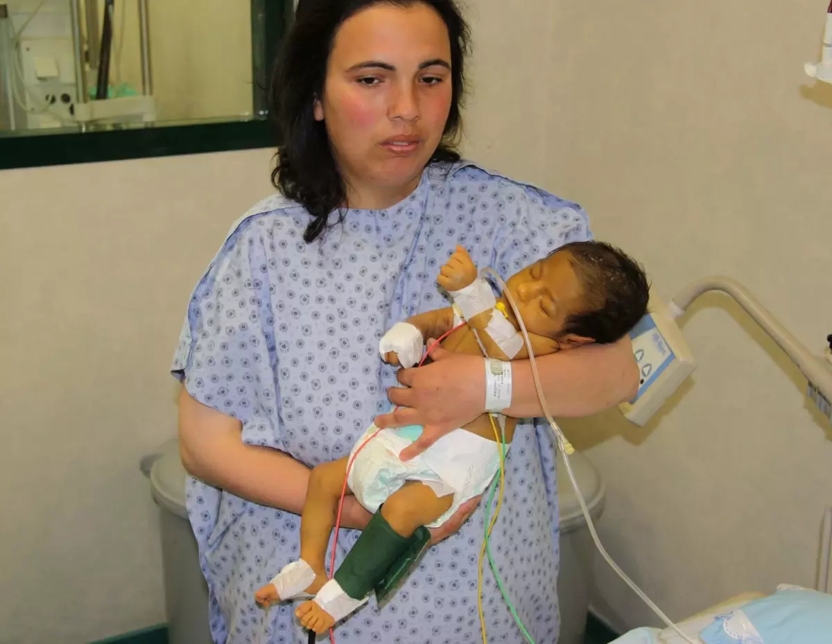 70 Günlük Bebeğe Anneden Karaciğer Nakli Yapıldı