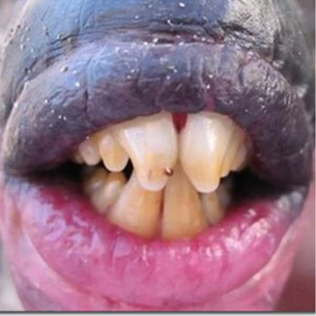 İnsan Gibi Dişleri Ve Dudakları Var!