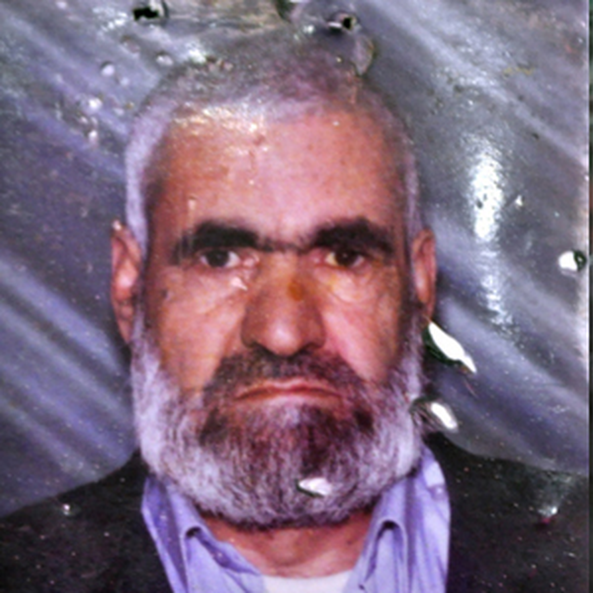 Sinir Hastası Genç Babasını Öldürdü