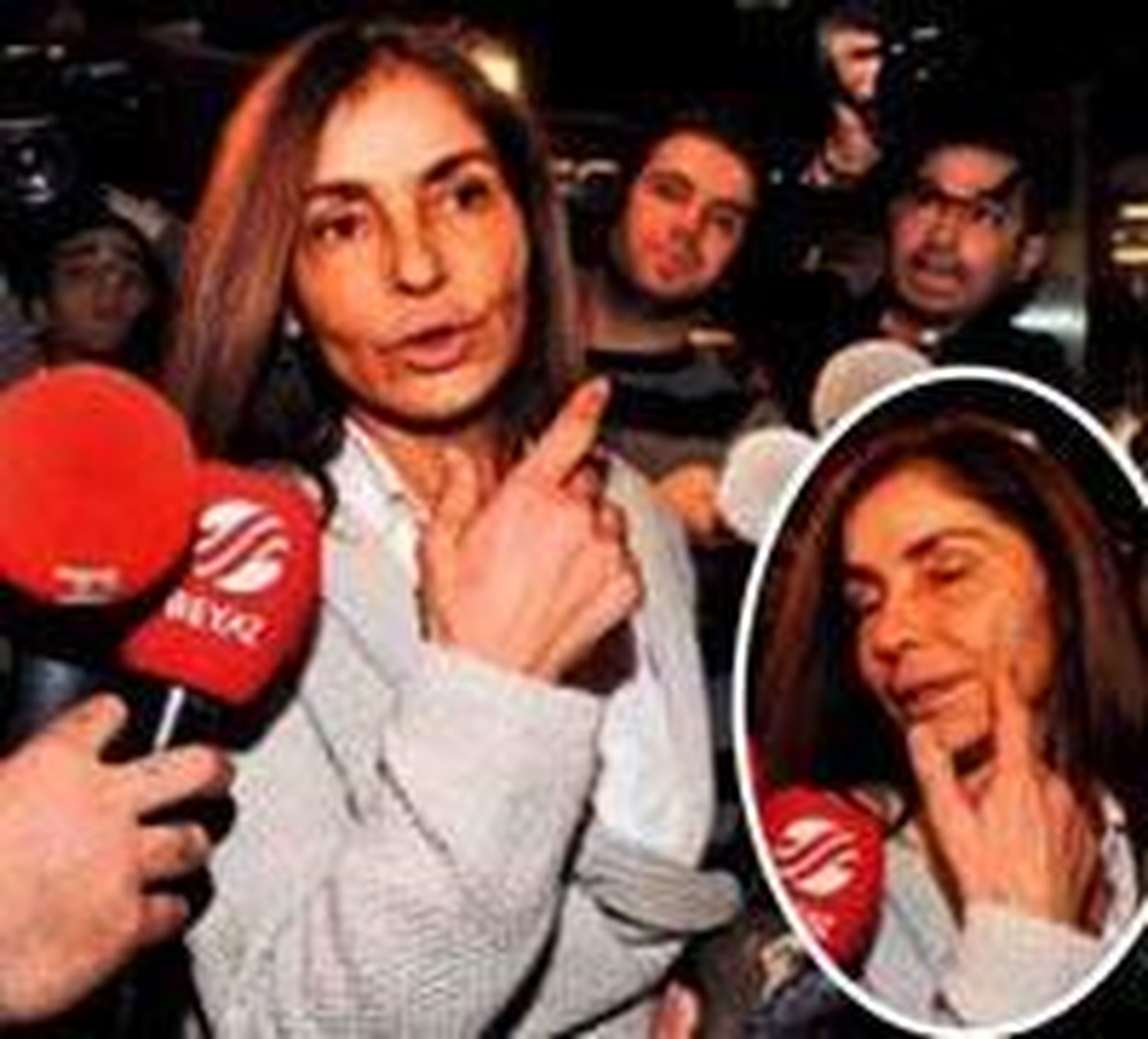 Yaralı Yüz!
