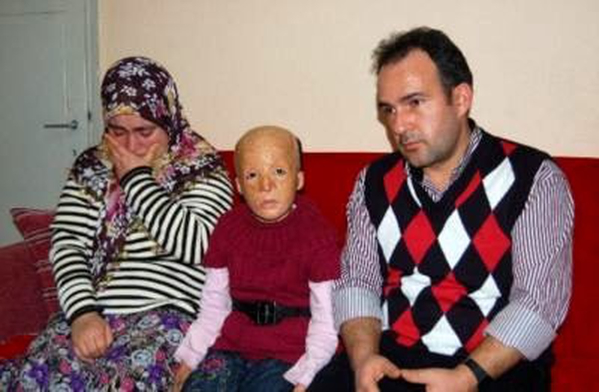 9 Yaşında 32 Kez Ameliyat Oldu, 30 Kez Daha Ameliyat Olması Gerekiyor