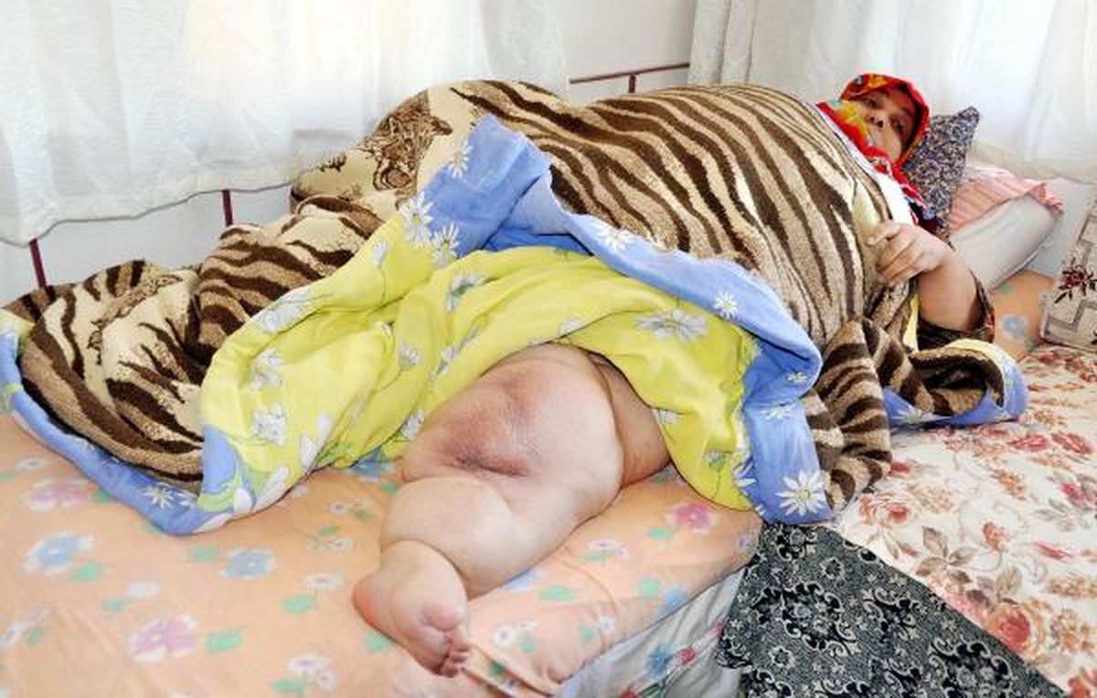 307 Kilo Ağırlığında!