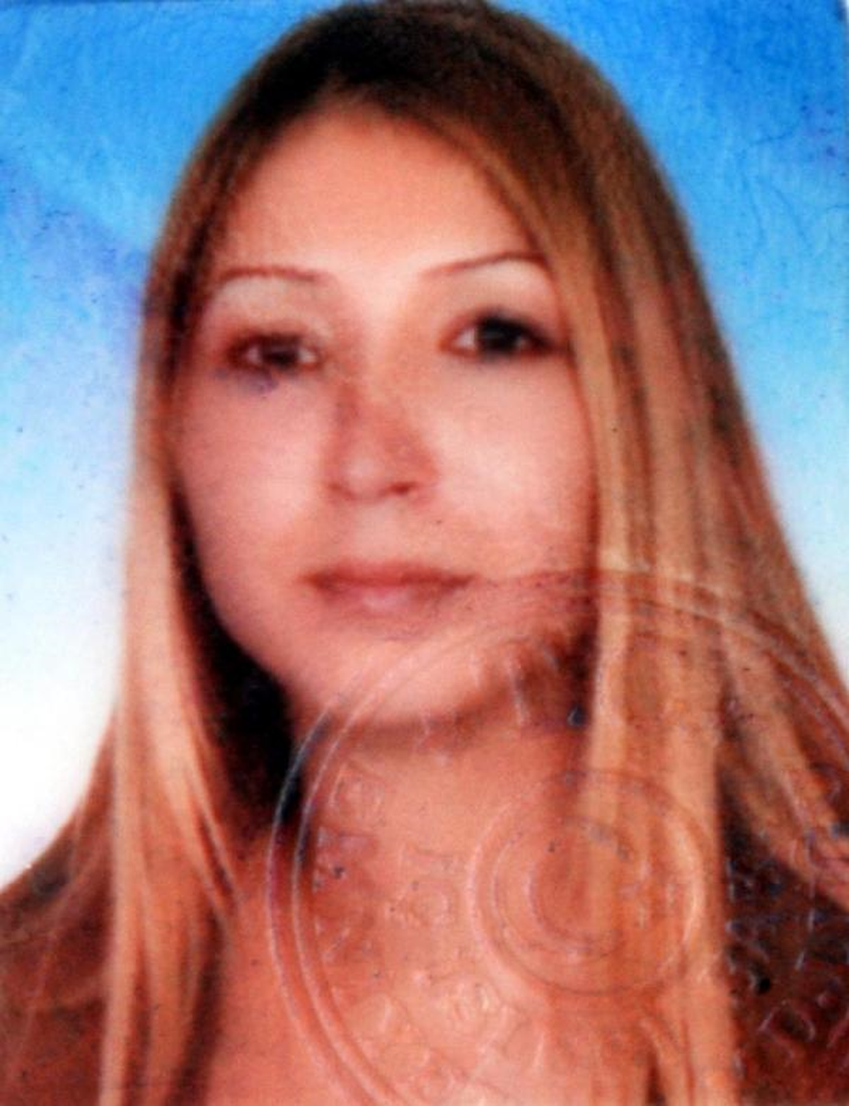 Sevgilisinin Başından Vurduğu Emine, Yaşam Savaşını Kaybetti
