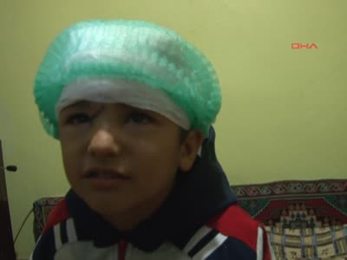 Köpekler Ömer\'i Hastanelik Etti