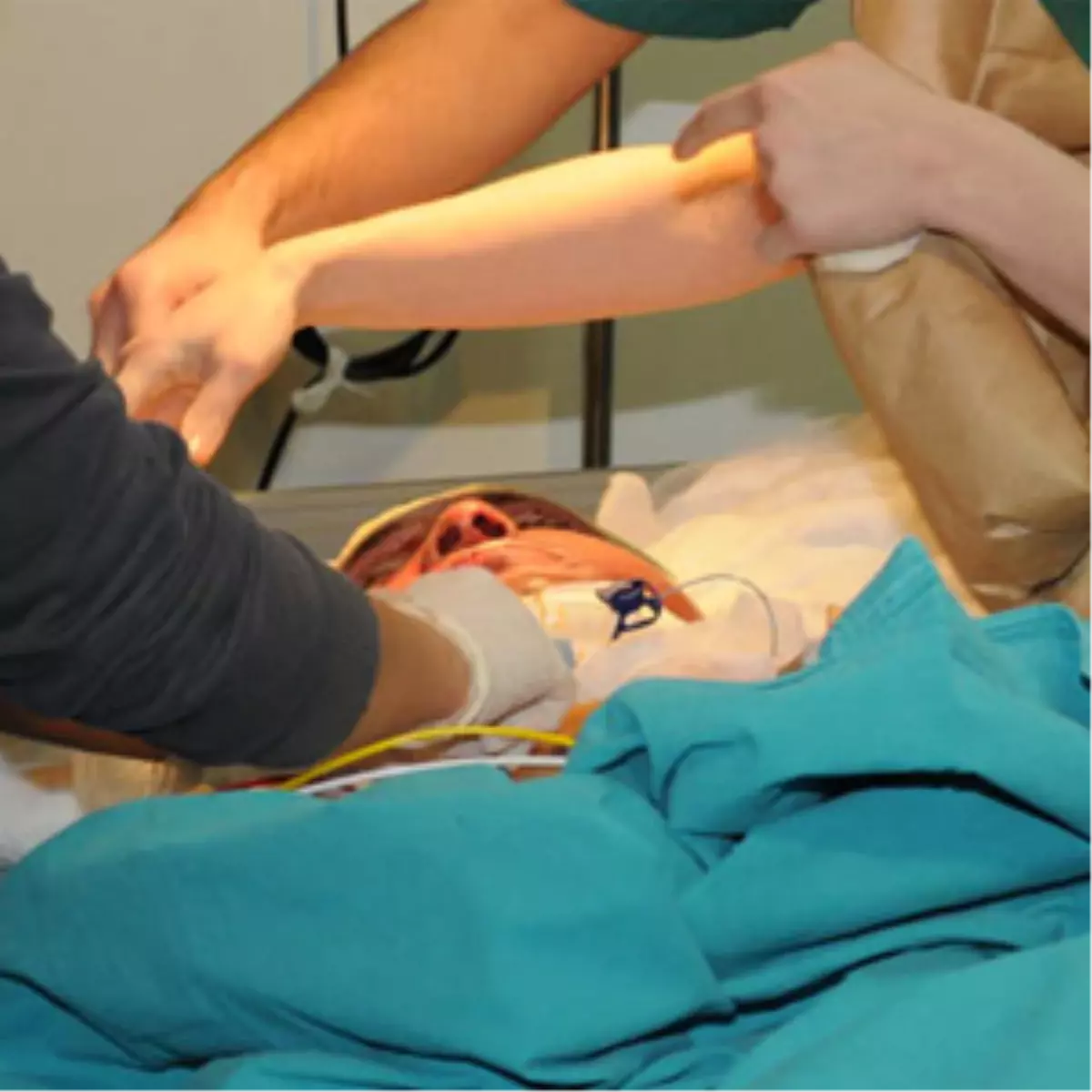 Tarihi Ameliyat Dünya Basınında