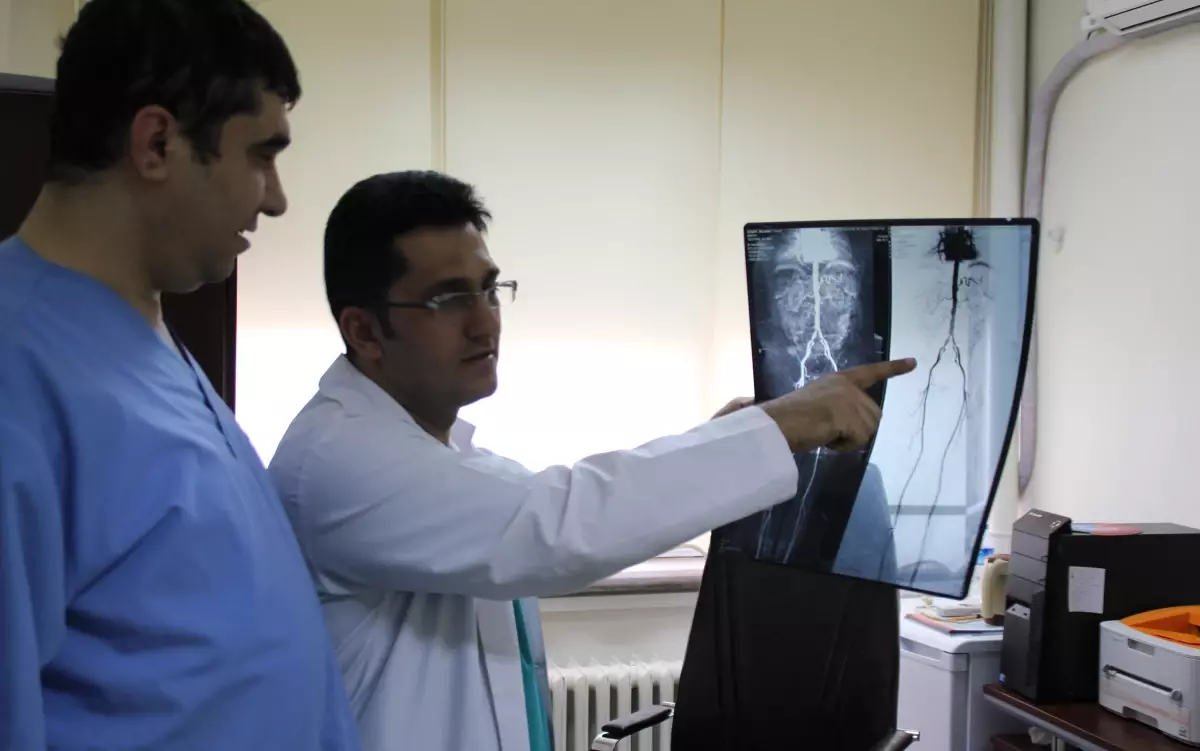Periferik Arter Hastalarına Ameliyatsız Çözüm
