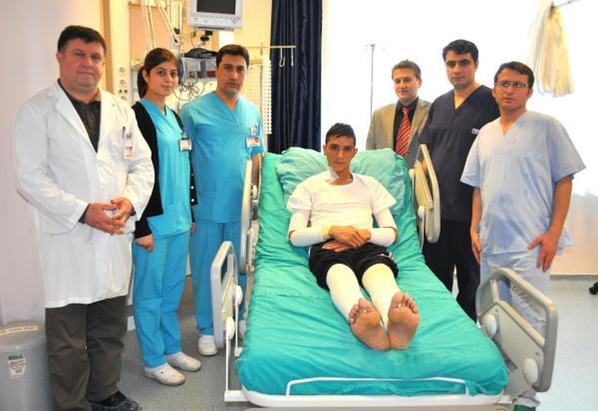Yanan Bacaklarına, Kollarından Deri Nakli Yapıldı