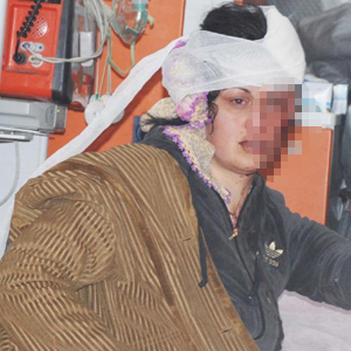 İki Kadının Erkek Kavgası Kanlı Bitti!