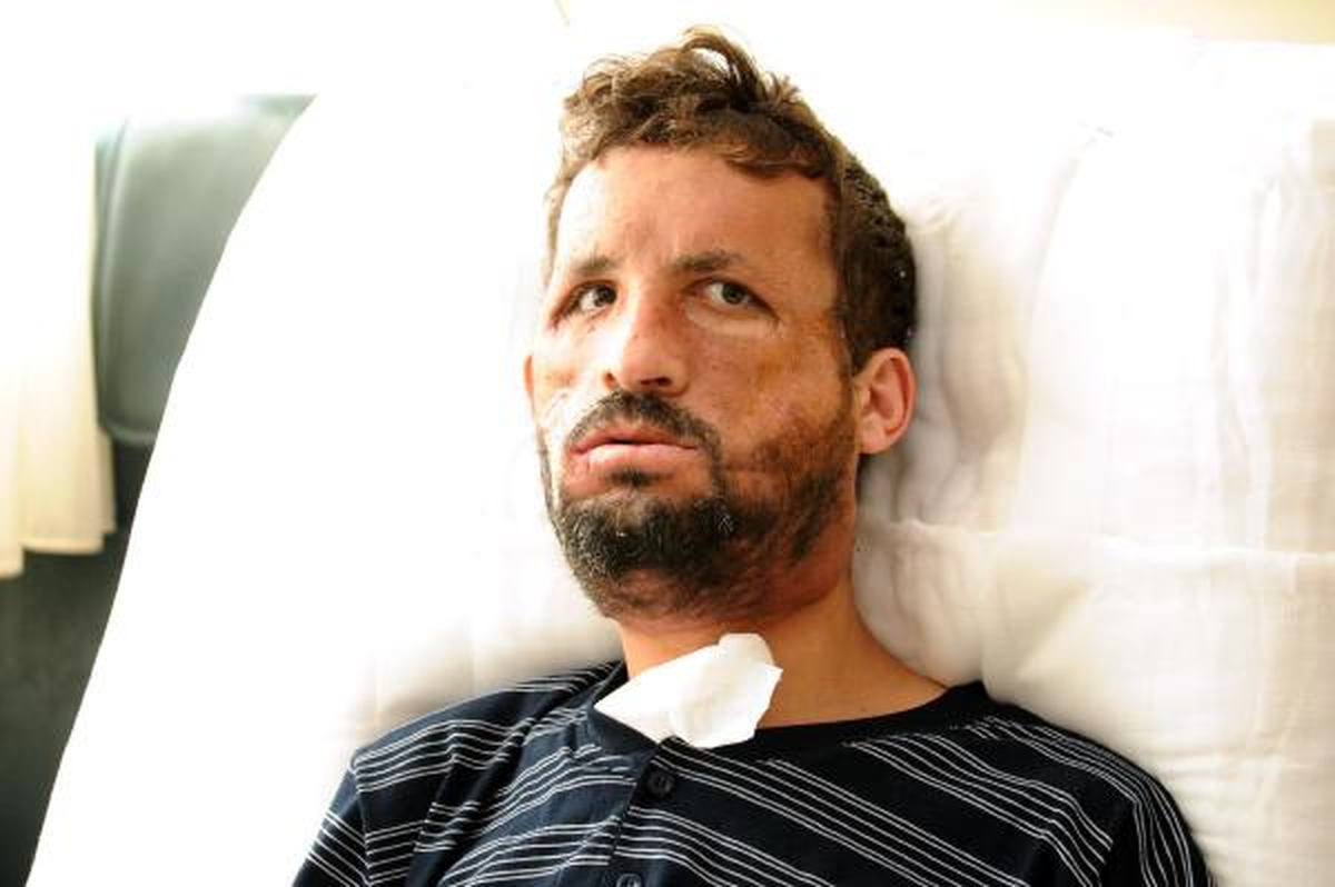 23 Gün Önce Yüz Nakli Olan Uğur, Sakal Tıraşı Oldu (2)