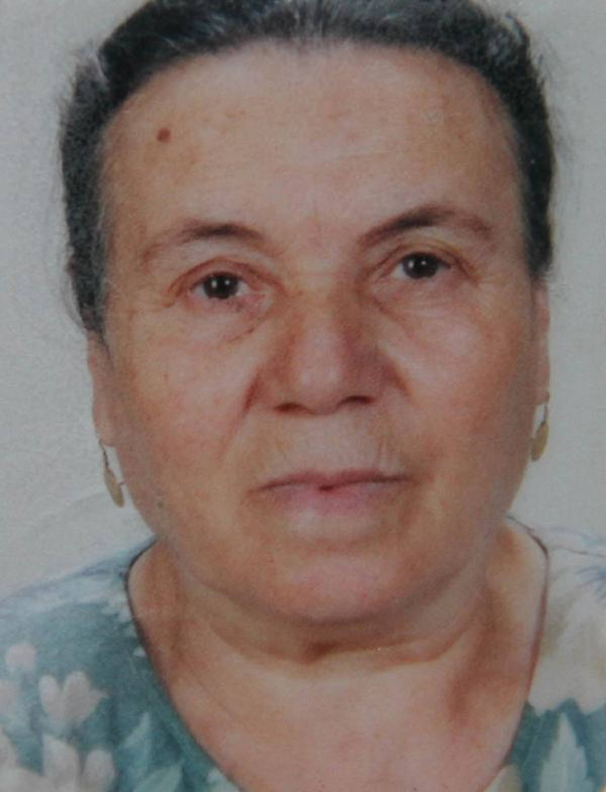 52 Yıllık Evli Mutlu Çiftini Yangın Ayırdı