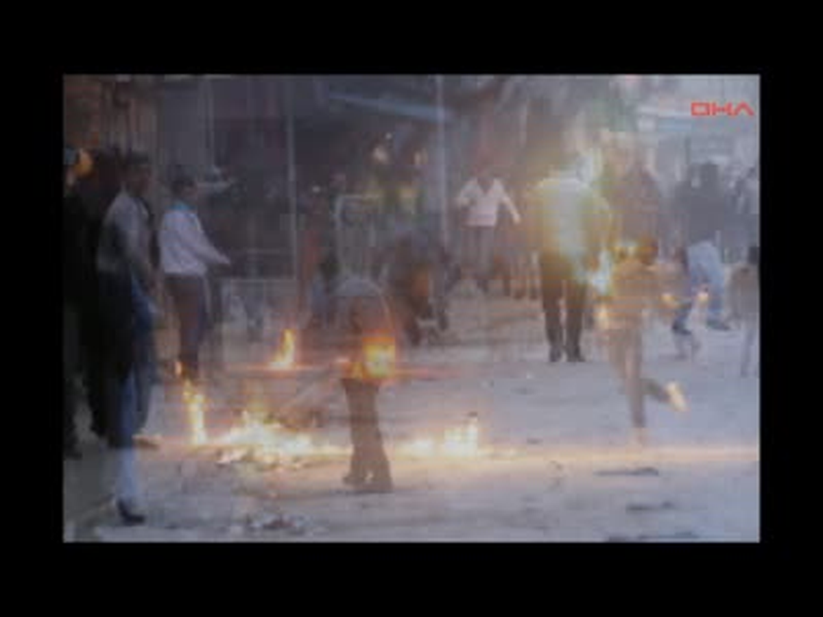 Polise Atmaya Çalıştığı Molotofla Kendisi Yandı