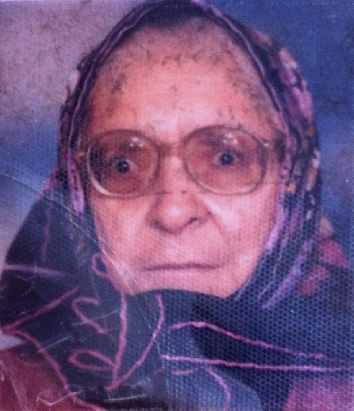 Yumurta Pişirirken Yanarak Can Verdi
