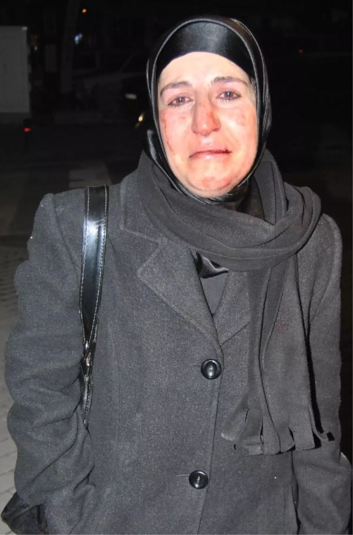 Evli Sevgilisi Tarafından Dövüldü