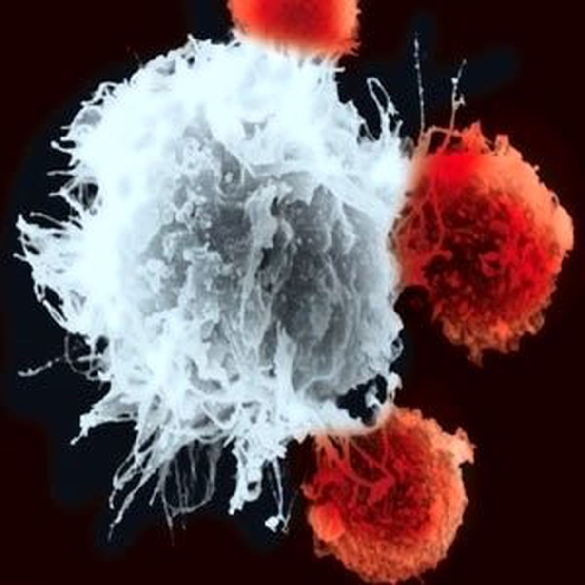 Kök Hücre ile Parkinson\'a Umut Işığı