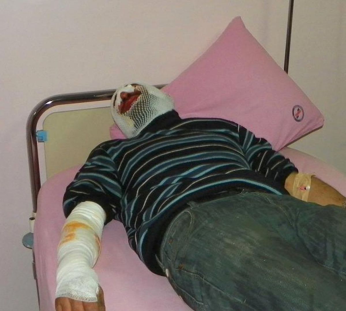 Kırıkkale\'de Piknik Tüpü Patladı: 4 Yaralı