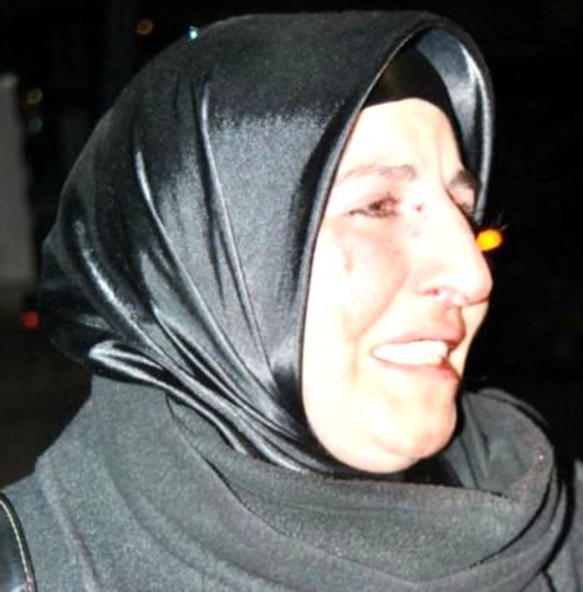 Kıskanç Koca, Ayrı Yaşadığı Karısını Hastanelik Etti