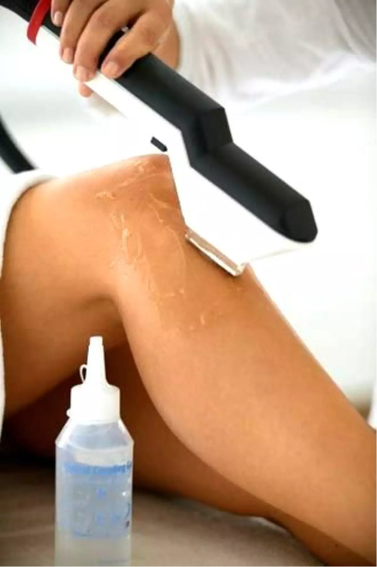 Ergenlik Çağında Epilasyon Yapılabilir mi?