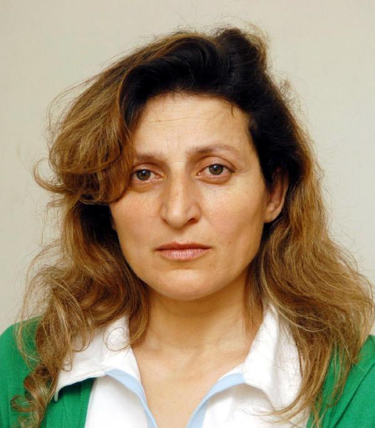 Karaciğer Nakli Yapılan Kadının Dayak İsyanı