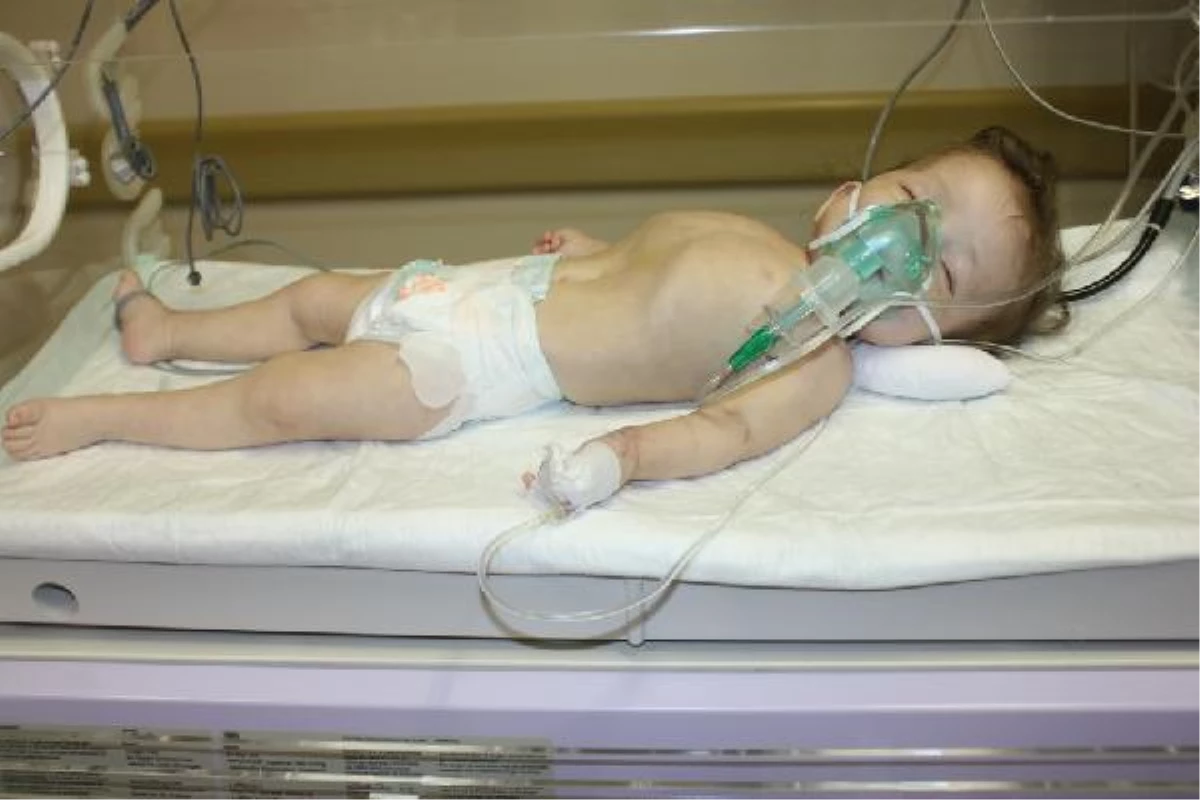 10 Aylık Bebek Dayaktan Hastanelik Oldu