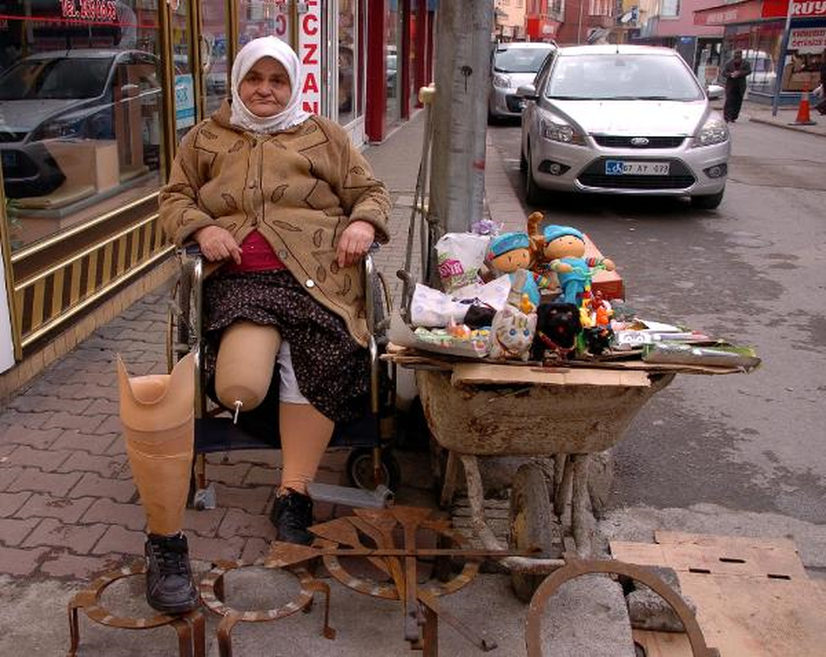 Protez Bacak ile Seyyar Satıcılık Yapıyor