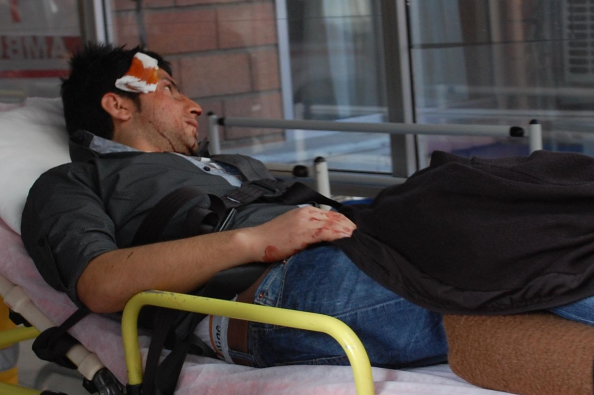 Kuaförde Tüp Patladı: 2 Yaralı