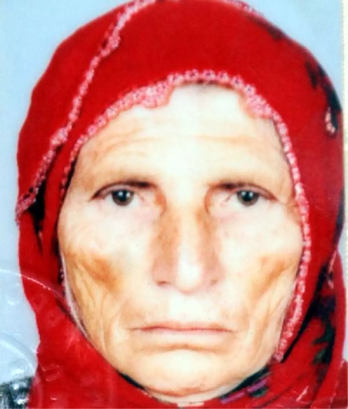 78 Yaşındaki Kadının Organları Bağışlandı