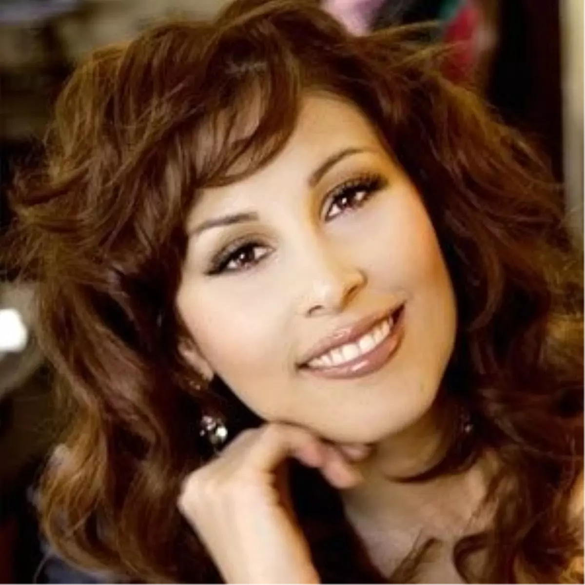 Ben mi Estetik Yaptırmışım?