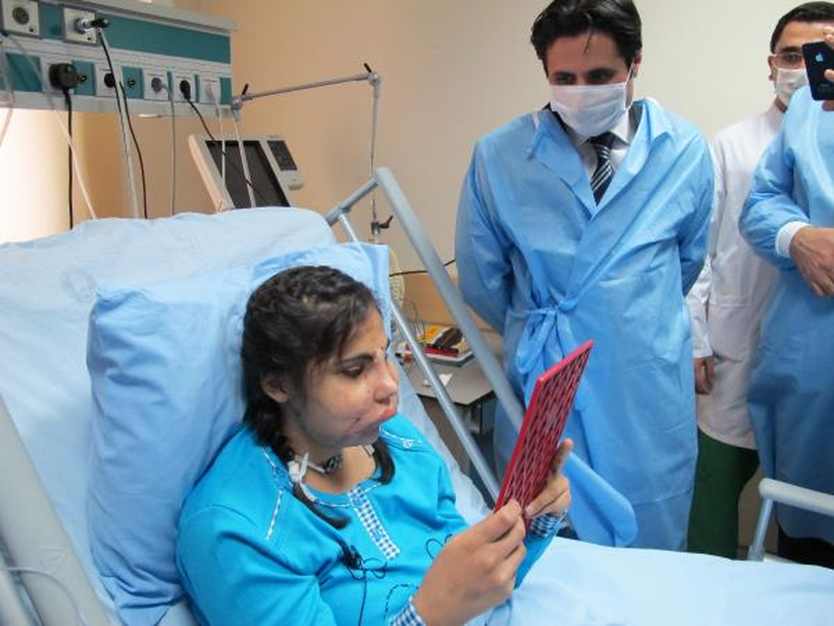 Yüz Nakli Yapılan Hatice Aynaya Baktı
