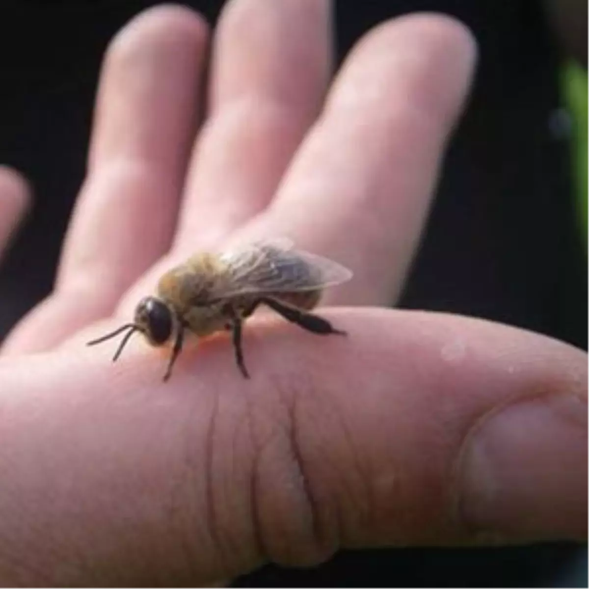 Arı Sokması Kalp Krizine Neden Oldu