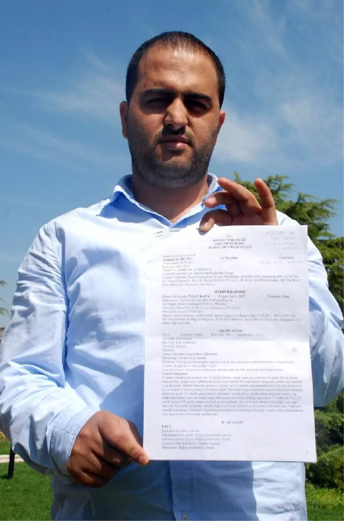 Narkozdan Öldüğü İddia Edilen Pusat\'ın Otopsi Raporu Açıklandı