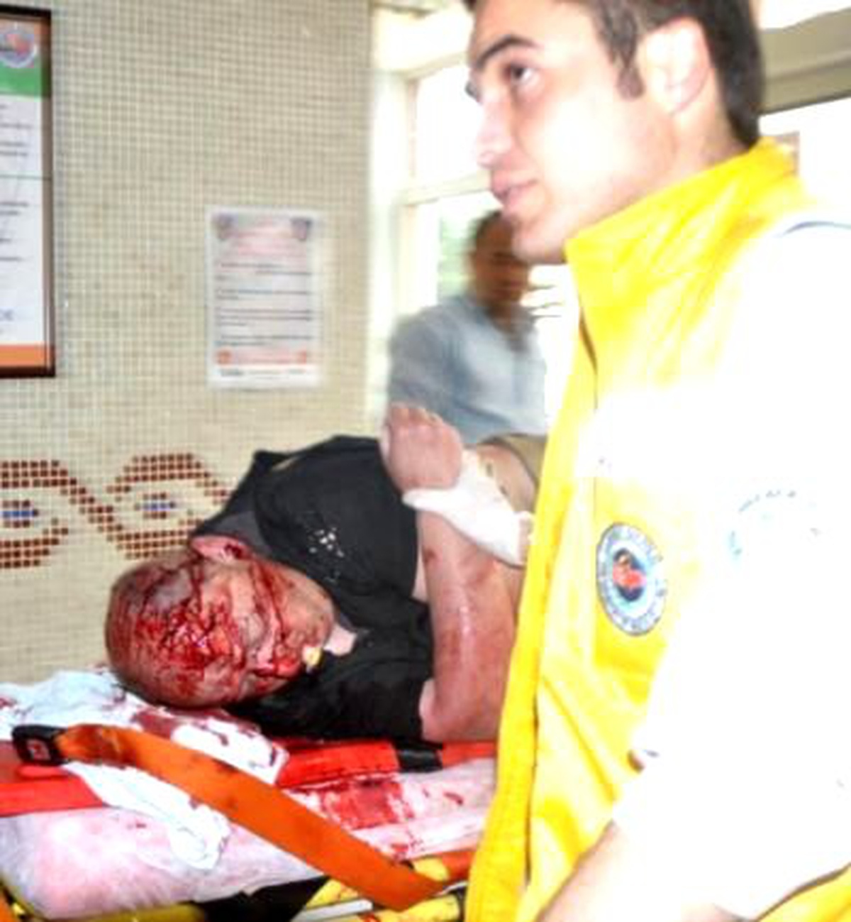 Bisikletle Tura Çıkan Alman Turist, Kazada Ağır Yaralandı