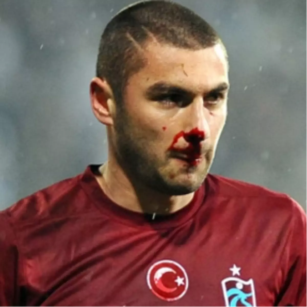 Burak Yılmaz\'ın Burnu Kırıldı