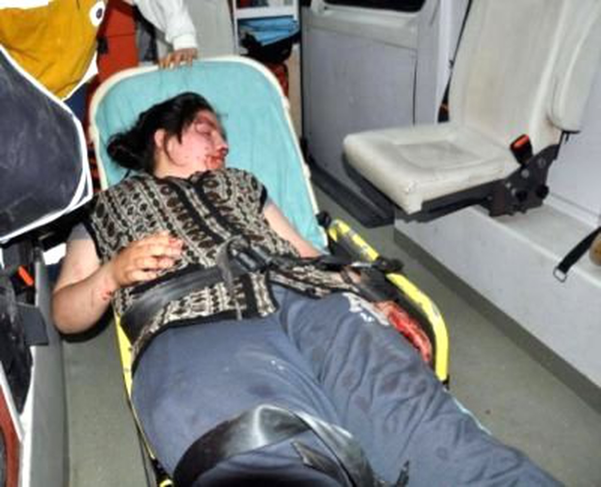 Eşini Dövmesine Tepki Gösteren Kızını Hastanelik Etti (2)