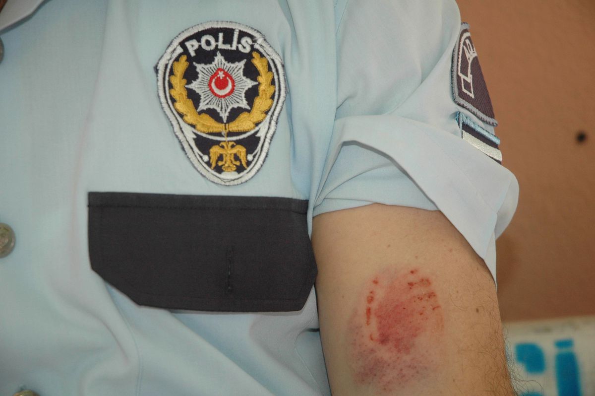 Alkollü Sürücü Polisi Isırdı