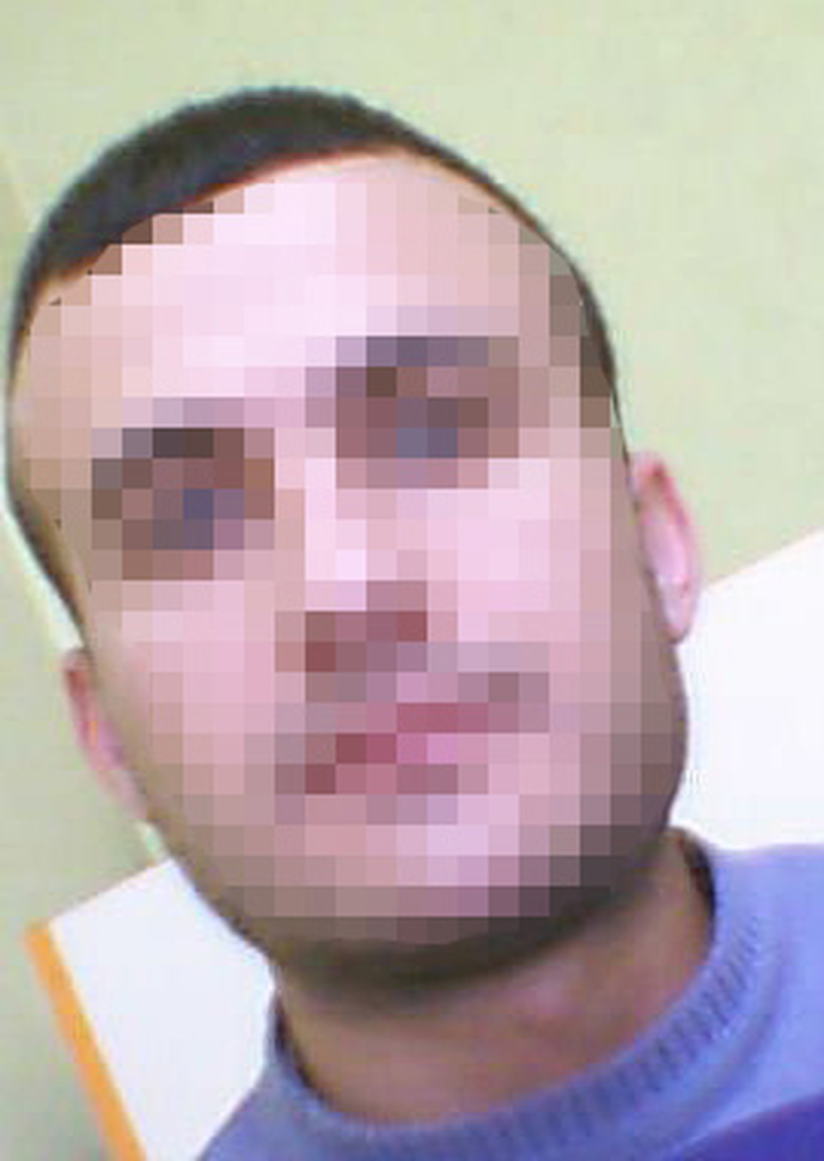 Öğretmenin Burnunu Kırdı