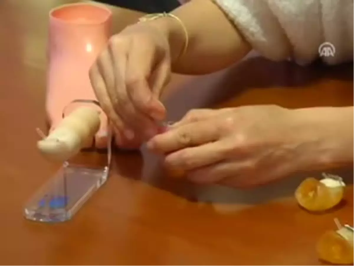 Tırnak Batmasına \'Tel\'li Çözüm