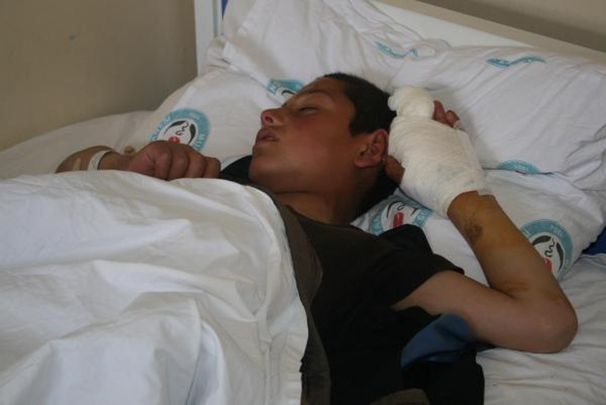 Aynı Aileden 7 Kişiyi Köpek Isırdı