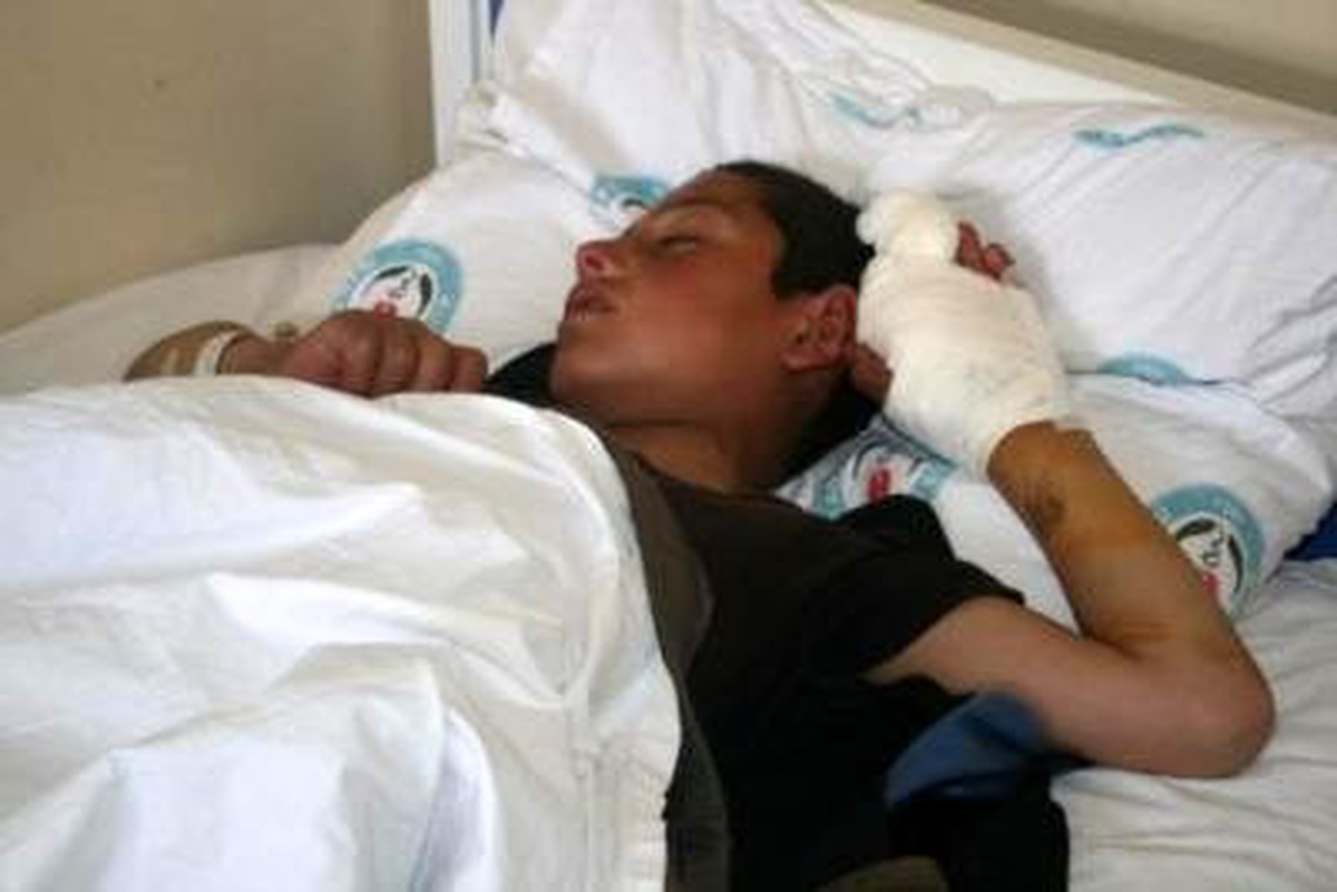 Aynı Aileden 7 Kişiyi Köpek Isırdı