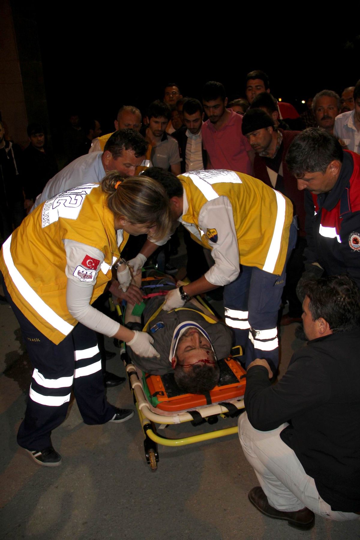 Otomobil Takla Attı: 1 Yaralı