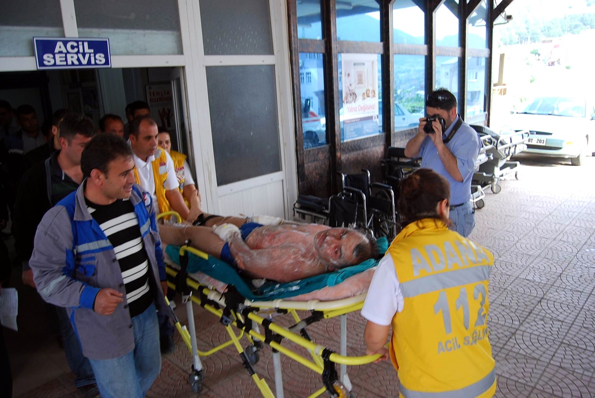 Trafo Tamir Edilirken Patladı 1 İşçi Yaralandı