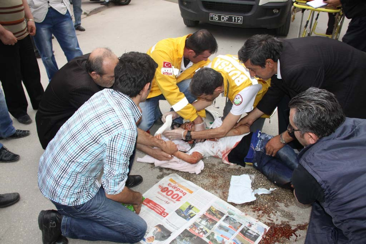 Otomobilin Çarptığı Çocuk Yaralandı