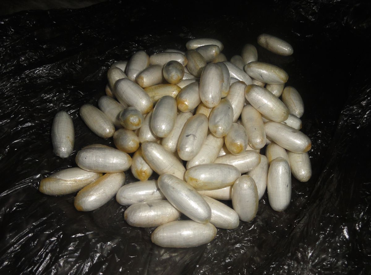 Midesinden 975 Gram Kokain Çıktı
