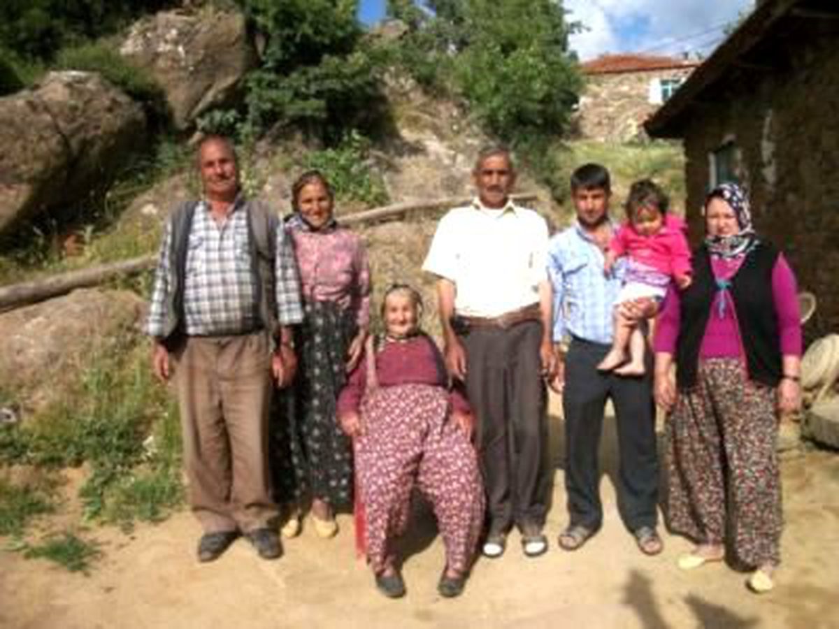 Türkiye'de 4'üncü Yüz Nakli Operasyonu (6)