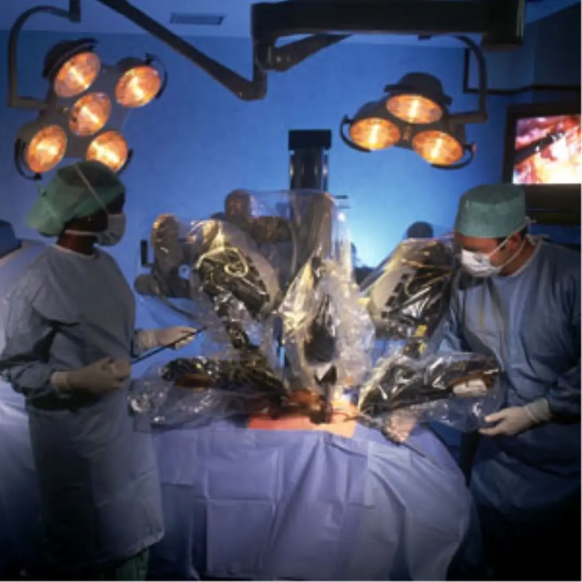 "Da Vinci" Robotu Baş-Boyun Kanserlerinde Görevde