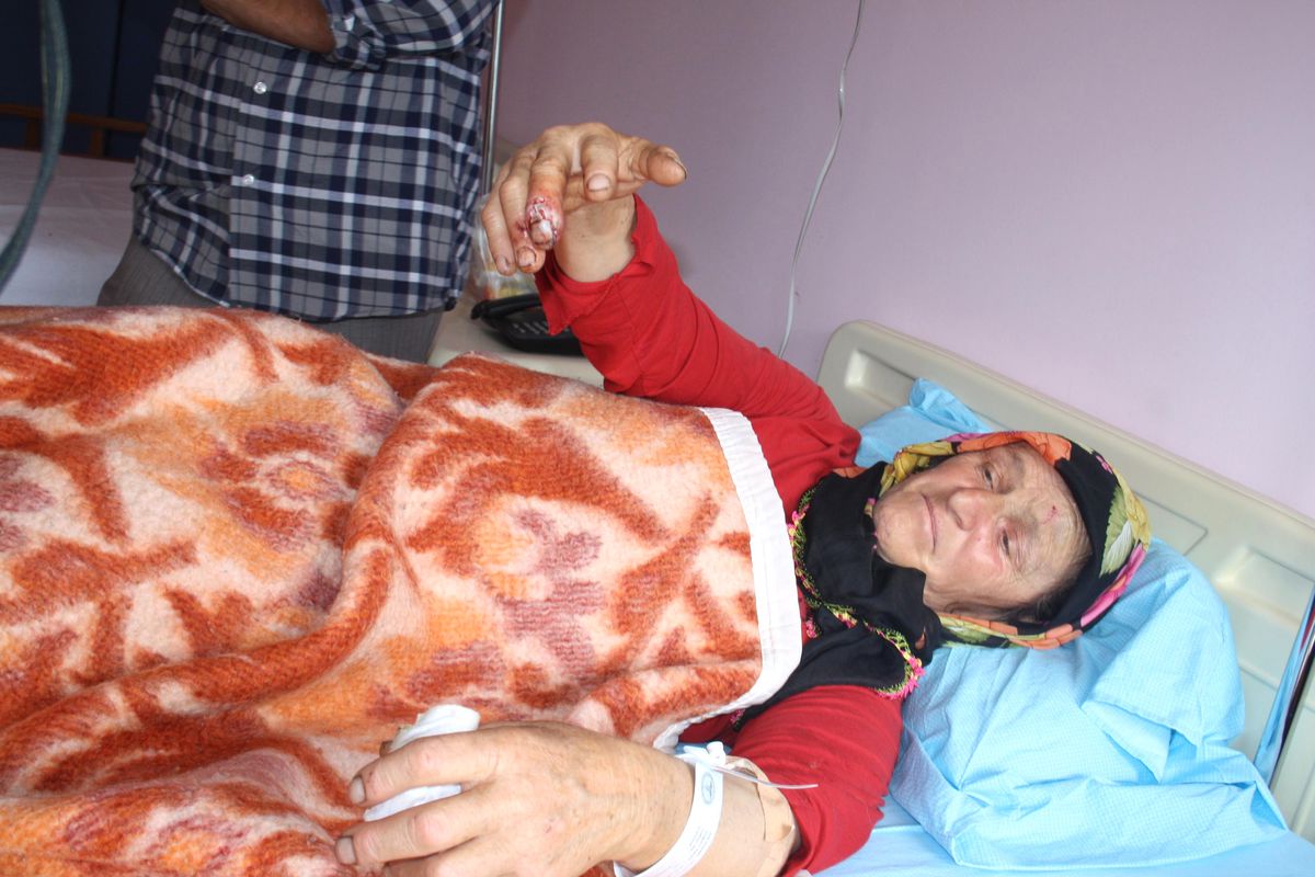 Artvin\'de Ayının Saldırısına Uğrayan Kadın Yaralandı
