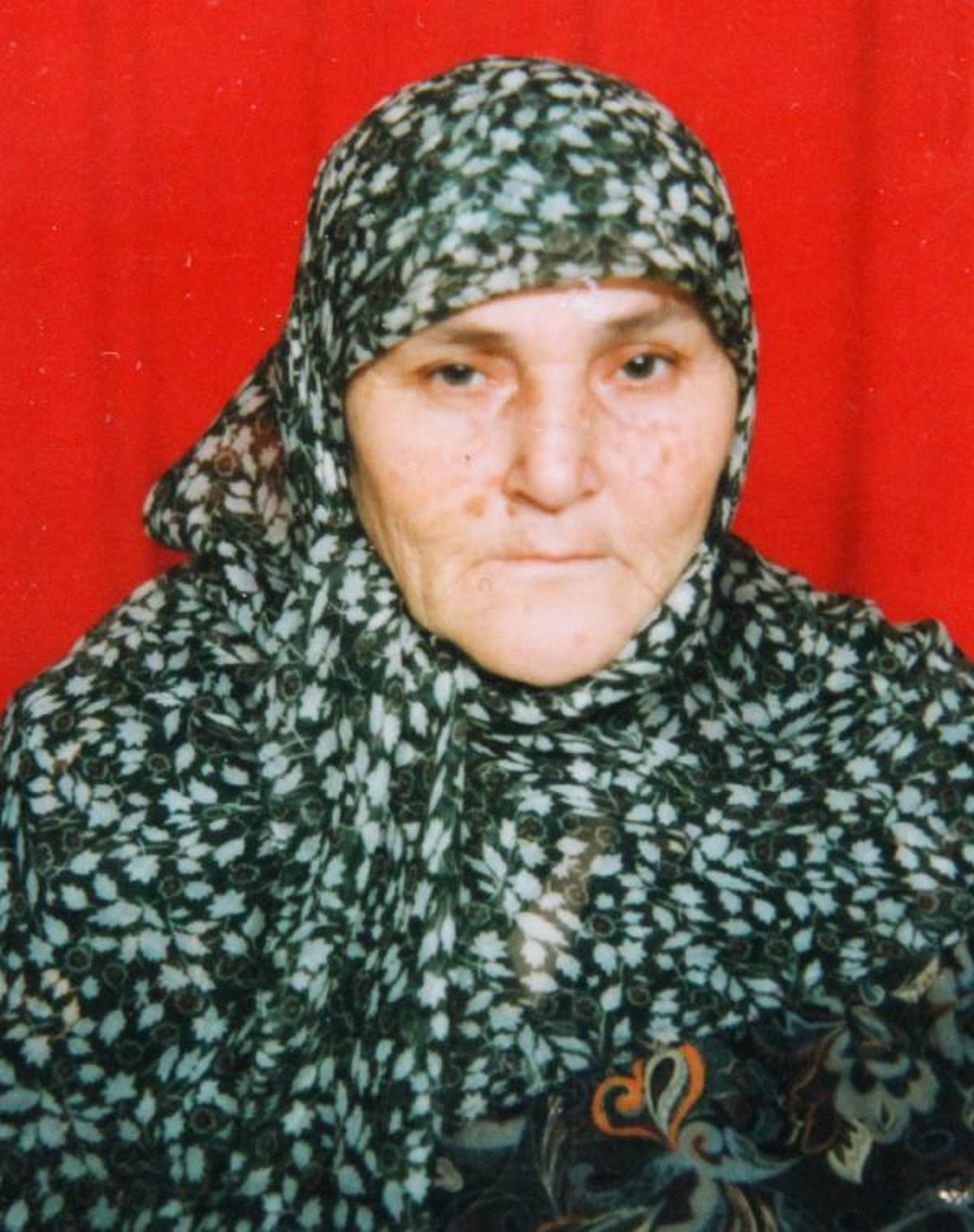 73 Yaşındaki Kadının Organları İki Kişiye Hayat Verdi